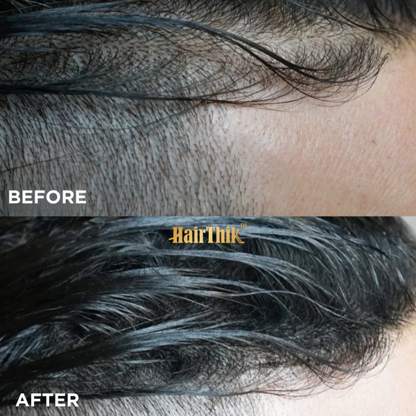 Supreme HairThik Hair Fibres Kit | Black - Image 2